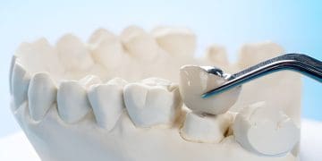 Ideiglenes fogpótlás és harapásemelés: két gyakori fogászati megoldás